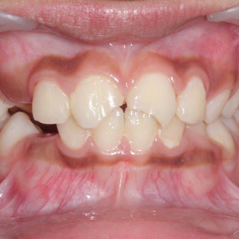 Before composite work