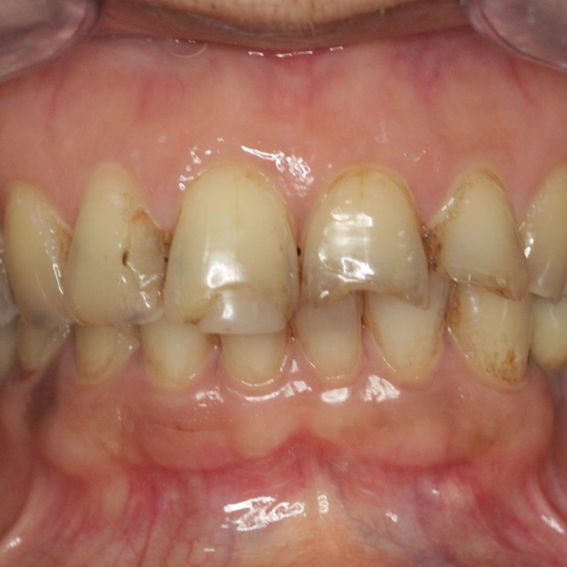 Before smile makeover